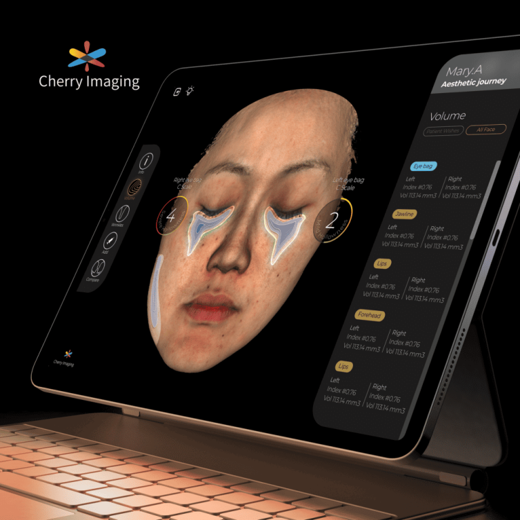 Cherry Imaging